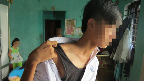 Truy tìm gã thanh niên chuyên bắt cóc nam sinh, giở trò đồi bại ở Thừa Thiên - Huế
