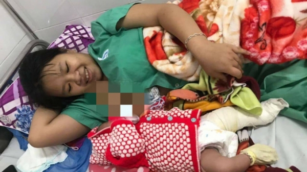 Bé trai gãy xương đùi sau khi sinh mổ tại Bệnh viện Đa khoa Quảng Nam