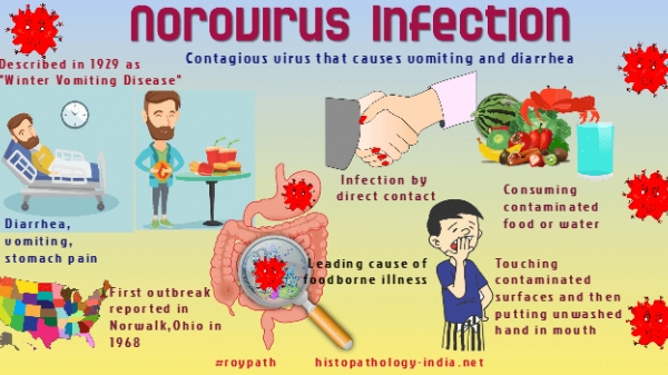 Phát hiện norovirus sau vụ ngộ độc thực phẩm