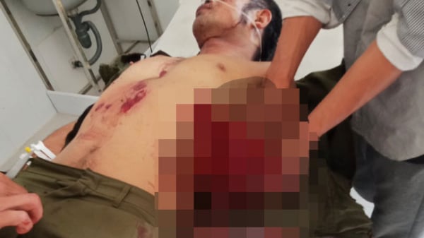 Lâm Đồng: 7 người bị thương vì mìn tự chế phát nổ
