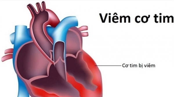 'Virus viêm cơ tim' lây lan qua đường hô hấp là không có cơ sở