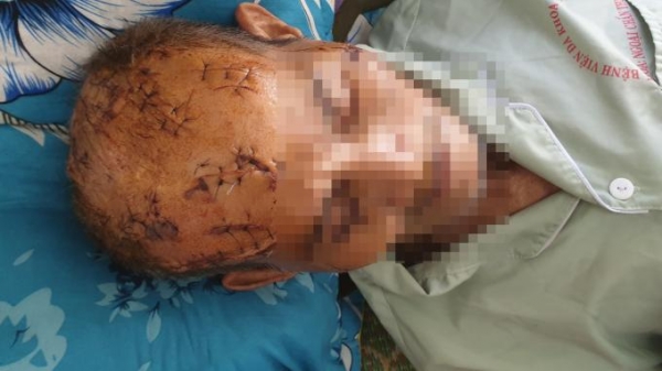Vụ cụ ông bị rạch đầu ở Phú Yên: Khởi tố người cháu nội