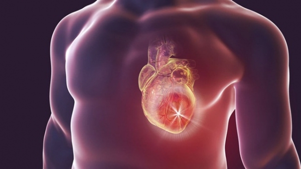 Suy tim sung huyết: Định nghĩa, triệu chứng và tiên lượng
