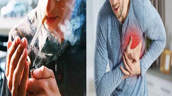 Hút thuốc lá làm tăng nguy cơ đột quỵ