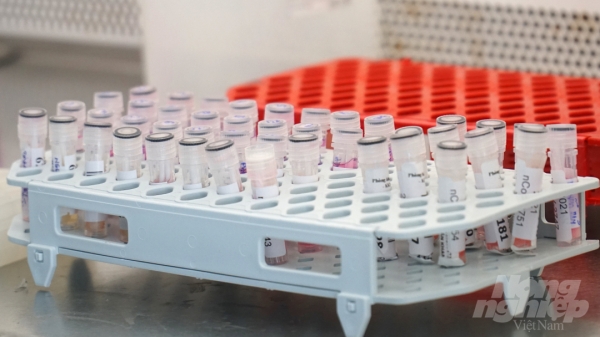 TP.HCM sắp triển khai test nhanh kháng nguyên SARS-CoV-2 tại cơ sở y tế