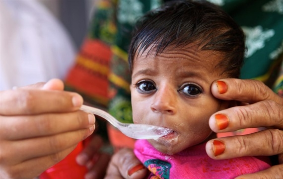 Hơn 500 triệu người Châu Á thiếu đói