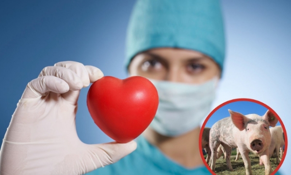 Pig heart transplant failure: Doctors detail everything that went wrong