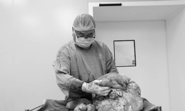 'Trục xuất' khối bướu khổng lồ hơn 20 kg cho bệnh nhân