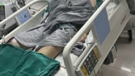 Một phụ nữ nguy kịch khi điều trị tại thẩm mỹ trị liệu