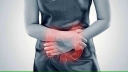 Viêm đại tràng có thể ngăn ngừa bằng phương pháp nào?