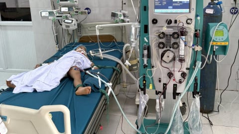 Ong vò vẽ tấn công khiến ba cháu nhỏ thương vong