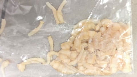 Sán dây 3 mét ký sinh đại tràng do thói quen ăn uống nguy hiểm