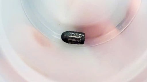 Hy hữu người phụ nữ sống sót dù bị đạn lạc găm trúng đầu