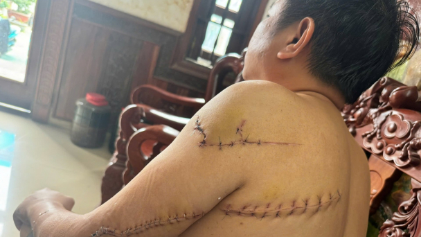 Chém người ‘dằn mặt’ chỉ vì mâu thuẫn tiền công tường rào trại gà
