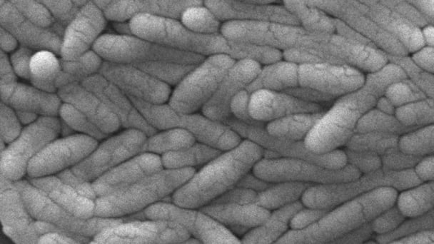 New salmonella outbreak is linked to backyard poultry
