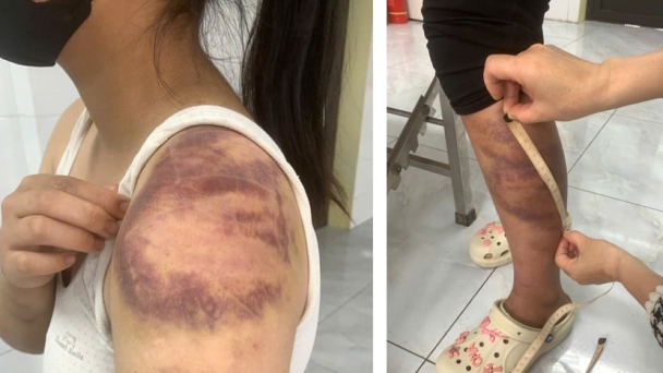 Tạm giữ hình sự đối tượng ngược đãi, hành hạ vợ con