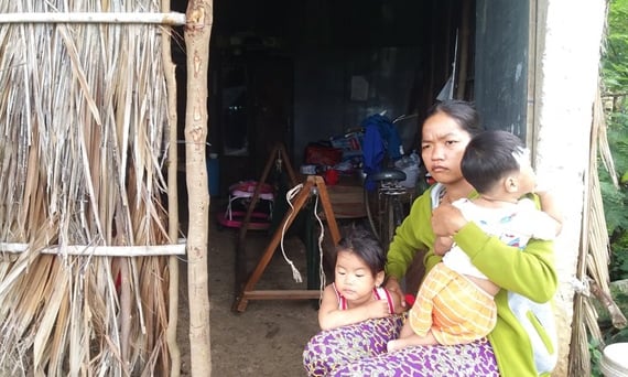 Hoàn cảnh cơ cực của nạn nhân bỏng nặng do cháy tàu cá