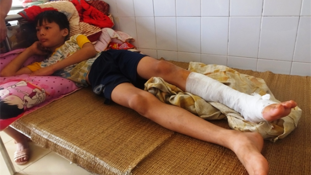 Không khởi tố vụ 75 người bị bỏng do đốt lửa trại ở Thanh Hóa