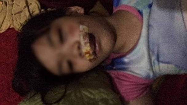 Hà Tĩnh: Chó “điên” tấn công nữ lao công trọng thương