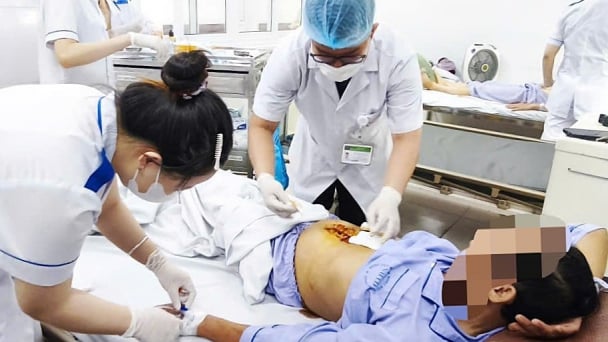 Sỏi mật tái phát, cụ ông 71 tuổi nguy kịch do viêm tụy cấp