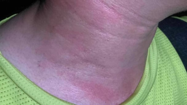 2 phóng viên bị hành hung ở Hà Nội