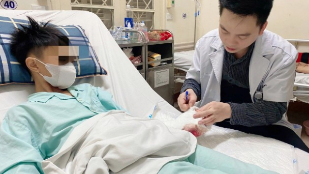 3 thiếu niên bị dập nát bàn tay do chơi pháo tự chế