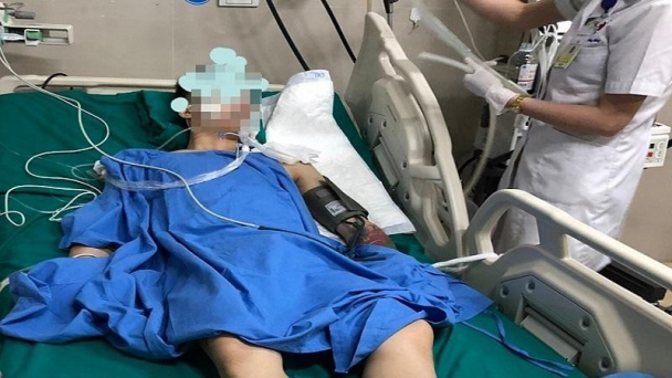 Hút 20 điếu thuốc mỗi ngày, thanh niên 25 tuổi bị đột quỵ não