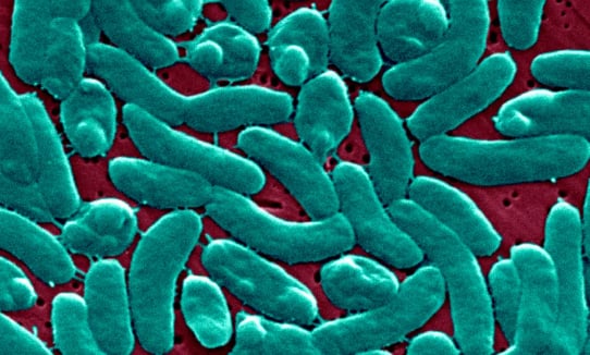 Flesh-eating bacteria cases are rising. Climate change is to blame, say scientists