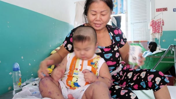 Tăng cường phòng chống dịch bệnh truyền nhiễm mùa mưa