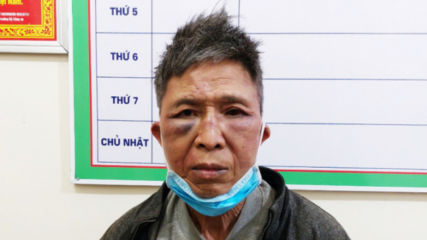 3 chiến sĩ công an bị thương khi truy bắt tội phạm ma túy
