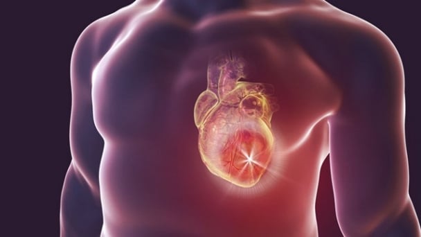 Suy tim sung huyết: Định nghĩa, triệu chứng và tiên lượng