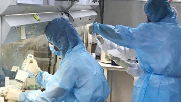 Yêu cầu báo cáo việc mua sắm máy Real-time PCR tự động phục vụ xét nghiệm