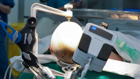 Robot AutoGuide lần đầu xuất hiện tại Việt Nam: Bước ngoặt công nghệ trong điều trị động kinh