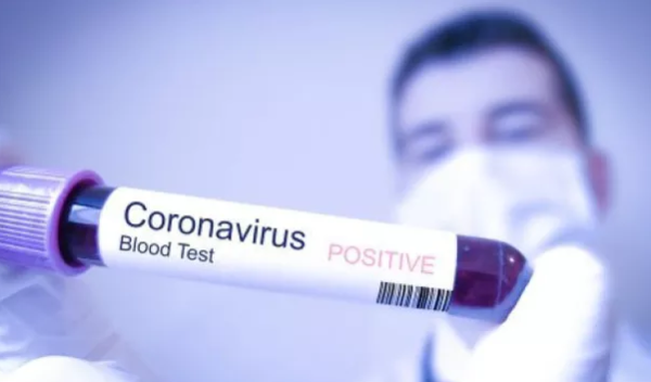 Đại dịch COVID-19: Các nhà khoa học tìm ra điểm yếu của virus