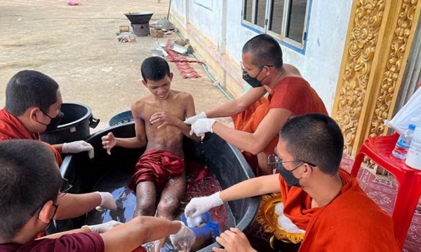 Hàng chục sư sãi tại một ngôi chùa ở Campuchia mắc bệnh lạ