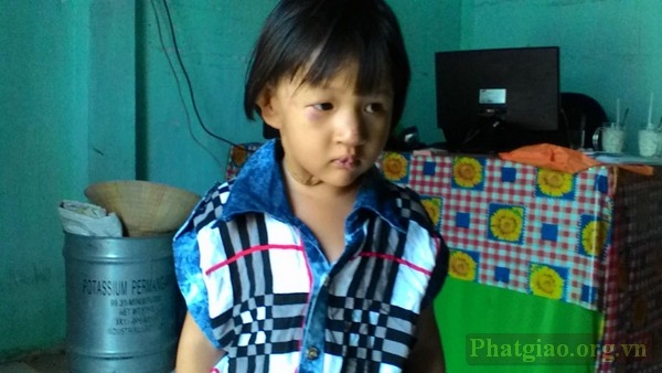 Sóc Trăng: Gia đình bé Thanh Thanh mong bé được mổ tim
