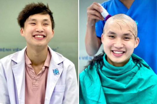 Bác sĩ trẻ cạo trọc đầu, rạng rỡ trước khi lên đường chi viện tâm dịch Bắc Giang