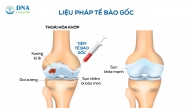 Đau hơn sau khi tiêm tế bào gốc trong điều trị thoái hóa khớp: Điều bình thường và cách xử lý