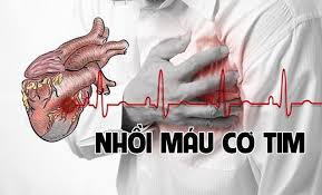 Bạn nên nhận biết những dấu hiệu sớm của nhồi máu cơ tim để có thể tự cứu sống chính mình