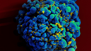 Bệnh nhân đầu tiên tự khỏi HIV mà không cần chữa trị