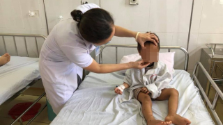 Bé trai 3 tuổi bị dập mi do bị thun bắn vào mắt
