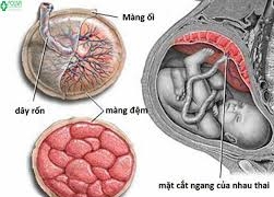 Các bà mẹ không nên xem nhẹ biến chứng dây rốn bám màng trong lúc mang thai