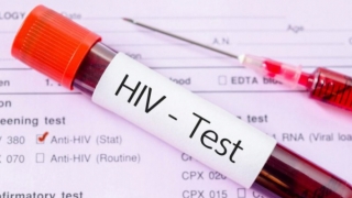 Sẽ tiến hành truy vết HIV như cách chống dịch COVID-19