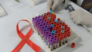 Sắp thử nghiệm vaccine ngừa HIV/AIDS trên người