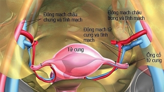 Việt Nam thử nghiệm ghép tử cung ở chó