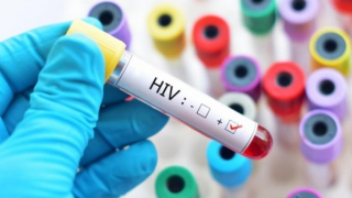 Nhiễm HIV làm tăng nguy cơ mắc COVID-19 nghiêm trọng: WHO cảnh báo