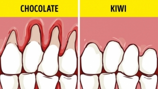 9 thực phẩm quen thuộc giúp răng miệng chắc khoẻ không nên bỏ qua