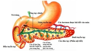 Những điều cần biết về căn bệnh viêm tụy cấp