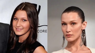 Bella Hadid chia sẻ ảnh hưởng của việc phẫu thuật thẩm mỹ quá sớm