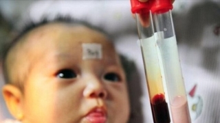 Sàng lọc Thalassemia - bệnh tan máu bẩm sinh